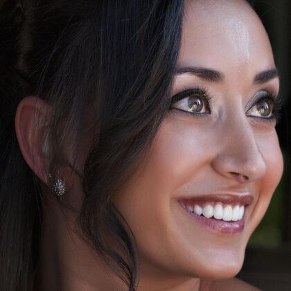 Smile Makeover & Veneers: Case 2 - After