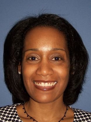 Deep Bite - Overlapping Teeth: Adult Deep Bite - After