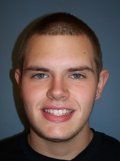 Deep Bite/Overlapping Teeth