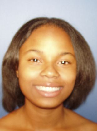 Deep Bite - Overlapping Teeth: Spaces and Deep Bite - After