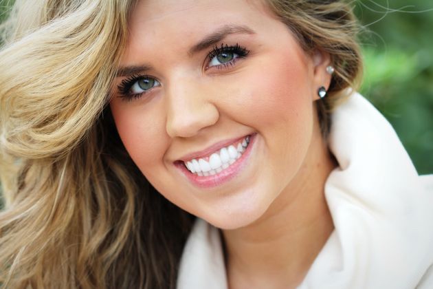 Veneers: Case 34 - After