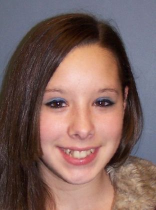 Amazing Smiles: Crowded Teeth - Before