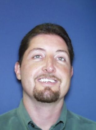 Open Bite: Uneven Open Bite - Before