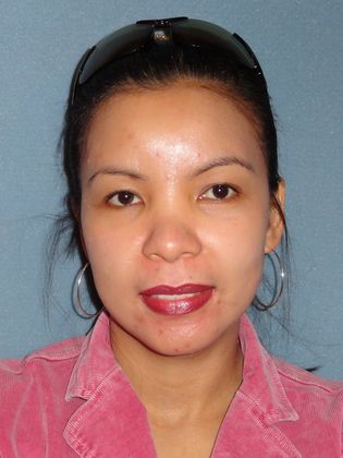 Obagi Skin Care: Case 3 - After