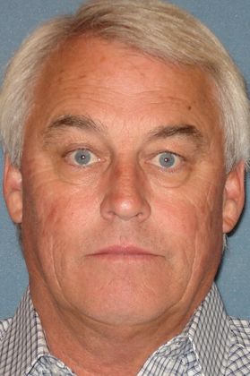 Laser Skin Resurfacing Case 10 - Before