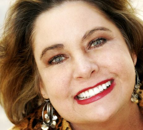 Veneers: Case 35 - After