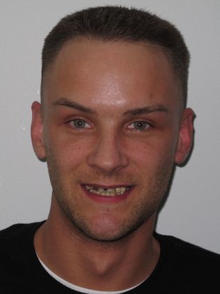 Cosmetic Crowns: Case 2 - Before